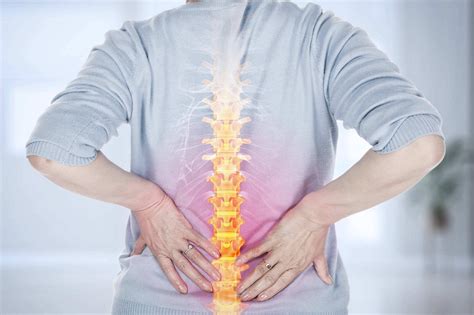 腰椎间盘突出症和马尾神经综合征有哪些关系？ - 知乎