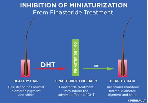 DHT: The Hair Killer | GL Perrault MD | Hair Loss and Hair Restoration