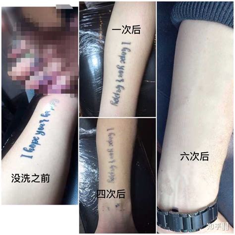 6个洗纹身后的效果图片-上海纹彩刺青