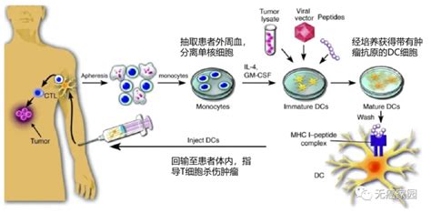 带你了解结直肠癌的治疗方法和手术方案 - 知乎