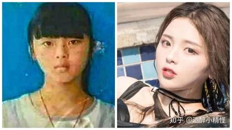 101女孩杨超越微博自晒童年旧照, 是整容脸还是自然脸一看便知