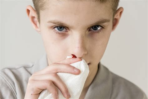 小孩流鼻血是什么原因 - 育儿知识