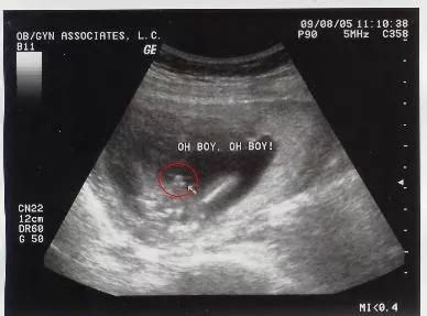 怀孕32周了，请帮忙看一下B超结果，着急取名字，B超结果能看宝宝的是男是女？请专业人回答！谢谢！ - 百度宝宝知道