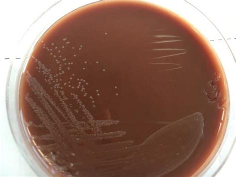 美国3M Petrifilm TM 微生物测试片6421肠杆菌科测试片 25片/包_3M食品安全_检验监测_食品加工_质安选