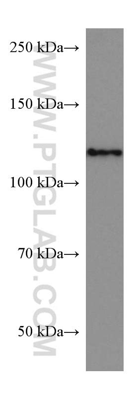 ACLY Antibody 67166-1-Ig | Proteintech
