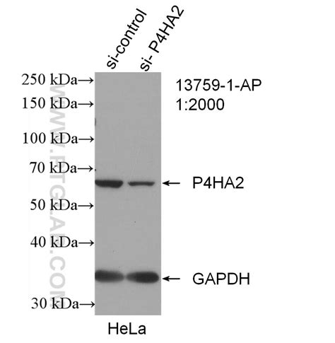 P4HA2 Antibody 13759-1-AP | Proteintech