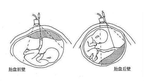 胚胎形成“时间轴”：怀孕几周可以看到孕囊、胎心胎芽？孕妈收藏