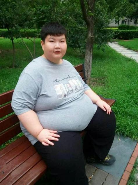 10岁男孩患小胖威利症，天性就是必须吃，体重飙到300斤！