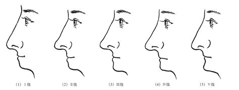 颏部具体位置图片