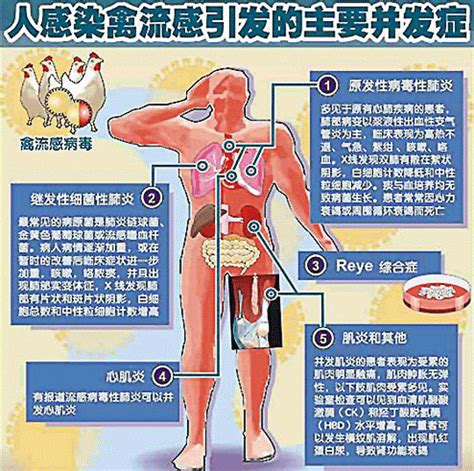 羽绒快讯 | 港府公报：广西柳州一女子感染甲型禽流感H5N6 - 羽绒金网