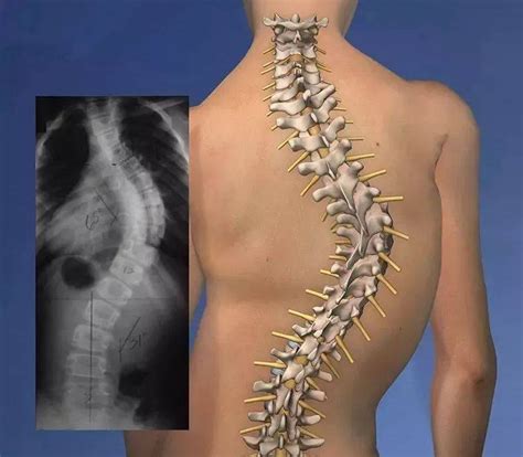 腰椎椎间盘解剖部分医学概念作为人体背部骨骼的特写，作为椎骨放大，脊髓和椎间盘作为 3D 插图在白色上隔离。高清摄影大图-千库网