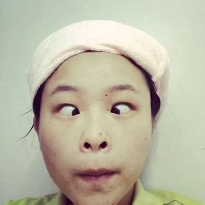 什么是斗鸡眼图片