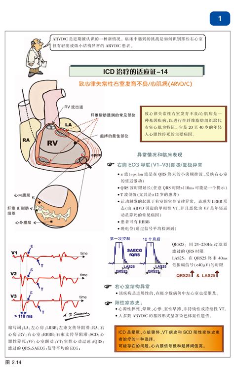 《置入式心律转复除颤器（ICD）图解阶梯教程》中文版发布 -- 严道医声网