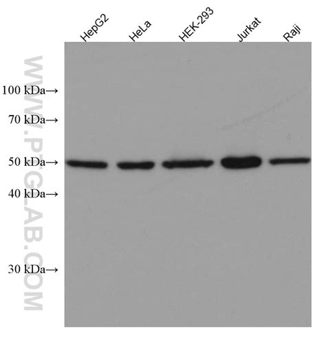 Cyclin A2 Antibody 66391-1-Ig | Proteintech