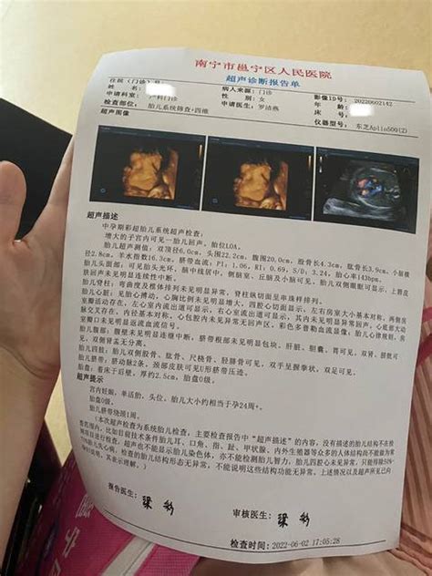 NT检查能查出胎儿所有畸形吗？__上海百佳妇产医院【官网】