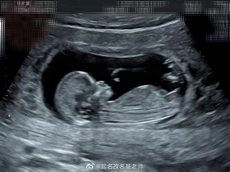 任家萱怀孕了，肚子里宝宝小名也取好了，名字叫小腰果！