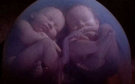 今天双胞胎剖腹产出来了_十月怀胎_趣宝贝