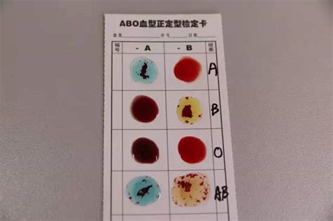 血型ab 是什么意思 - 业百科