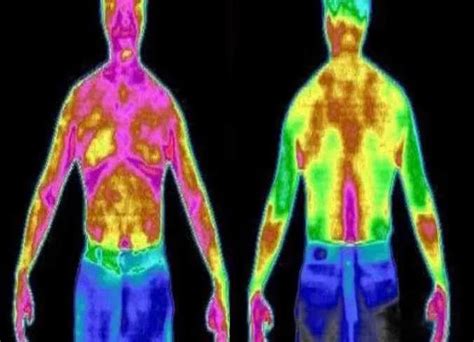 医用红外热成像评估人体健康状态-华景康热成像健康管理官网