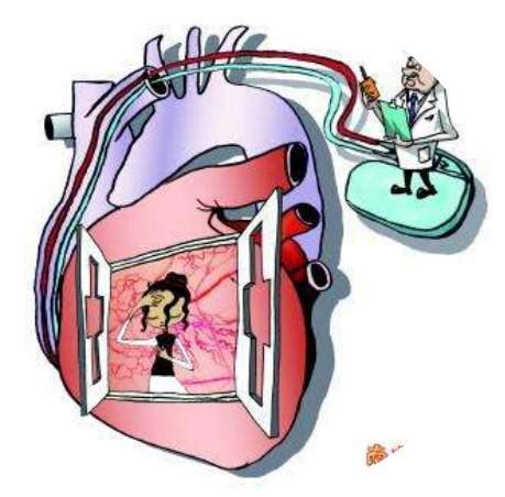 专家解答：安装心脏起搏器后，患者最关心的7个问题