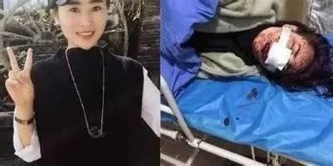 丽江被打女孩136天后首次公开近照和遗书(含视频)_手机新浪网