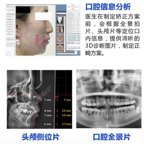 九江中山口腔医院哪个医生好？介绍种植牙、矫正医生名单,牙齿对比照片-8682赴韩整形网