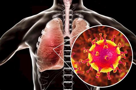 新型冠状病毒感染的肺炎 —— 健康科普知识（一）