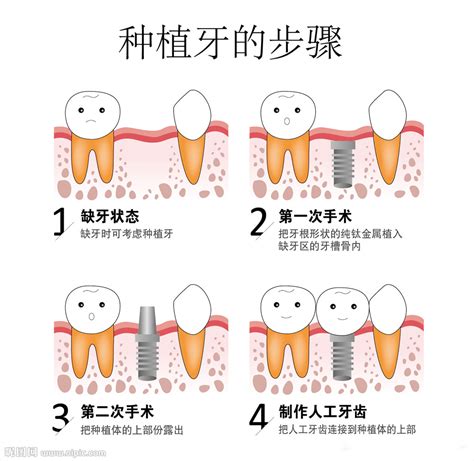 北京昌平区口腔专科医院推荐,天通苑和回龙观也有牙科上榜-欣美整形网