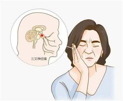 【神经性头痛】【图】造成神经性头痛的原因 5个日常小护理快速帮你缓解头疼_伊秀健康|yxlady.com