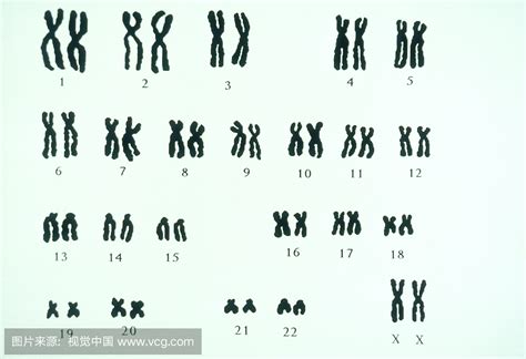 科学家首次完成对人类X染色体的完整测序