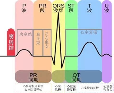 心电图连接示意图图片