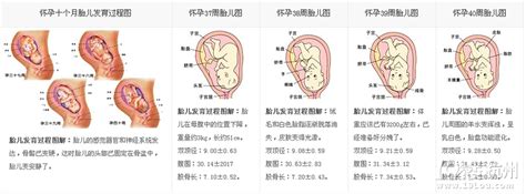 胎盘前置和胎盘前壁是一回事吗 孕期发生胎盘前置怎么办 _八宝网