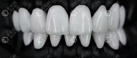 淮安口腔医院价目表:种植牙2980起/拔牙-智齿200起费用不高 - 口腔健康 - 毛毛网