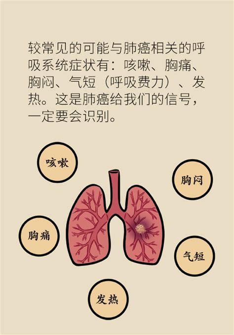 2.周围型肺癌-医学影像学诊断和报告-医学