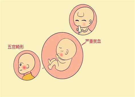 胎儿什么时候最容易畸形_民福康