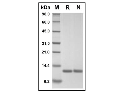 Anti-MIF Antibody [9]_北京华大蛋白质研发中心有限公司