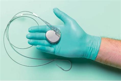 小心！无线心脏起搏器可能会要了你的命-医疗电子-与非网