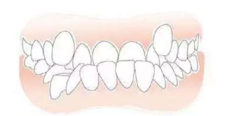 牙齿的解剖结构-基础医学-医学