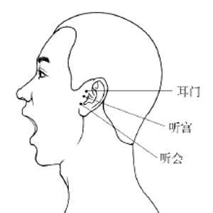 专家讲解：耳内经常有蝉鸣声或嗡嗡声，很可能是患上了神经性耳鸣__凤凰网
