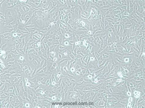 AC16 (人心肌细胞) (STR鉴定正确) - 武汉普诺赛生命科技有限公司 - 您身边的细胞专家【官方网站】