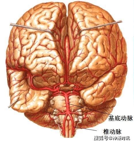 【脑血管名词辨析】脉络膜前动脉 脉络膜后动脉 - 脑医汇 - 神外资讯 - 神介资讯