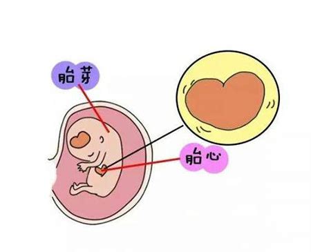 胎儿电子监护要点解读