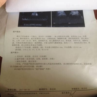 枕大池位置图片