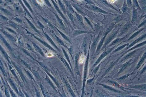 H9c2(2-1)细胞ATCC CRL-1446细胞 H9C2大鼠心肌细胞株购买价格、培养基、培养条件、细胞图片、特征等基本信息_生物风