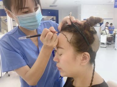 南京新生植发：为什么有人植发特别疼，植发手术到底疼不疼？_互联网_艾瑞网