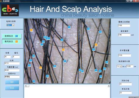 【终身保修】CBS-606 便携式毛囊密度 毛发头皮测试 分析检测仪器-阿里巴巴