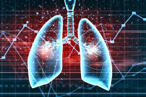 早期肺癌低剂量CT筛查 是预防肺癌的最有效措施_社会热点_社会频道_云南网