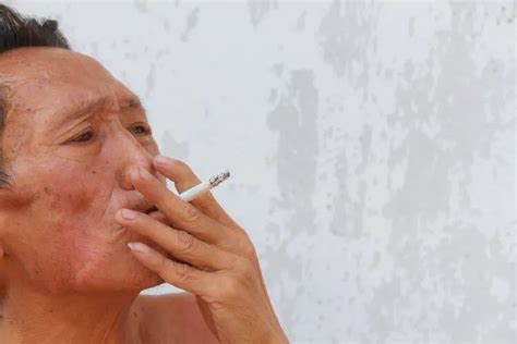 抽烟1年和戒烟1年，对身体有什么影响？不妨看看对比吧_肺部