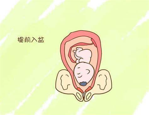 胎儿入盆有早有晚，早入盆、晚入盆各是什么原因造成的？