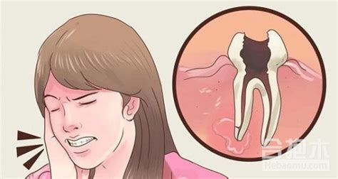 【智齿后面的牙肉肿痛】【图】智齿后面的牙肉肿痛怎么办 有何小偏方可以缓除疼痛_伊秀健康|yxlady.com